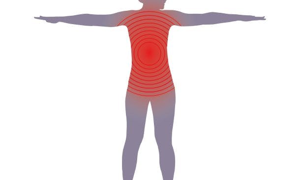 DiGAs bei Rückenschmerzen
